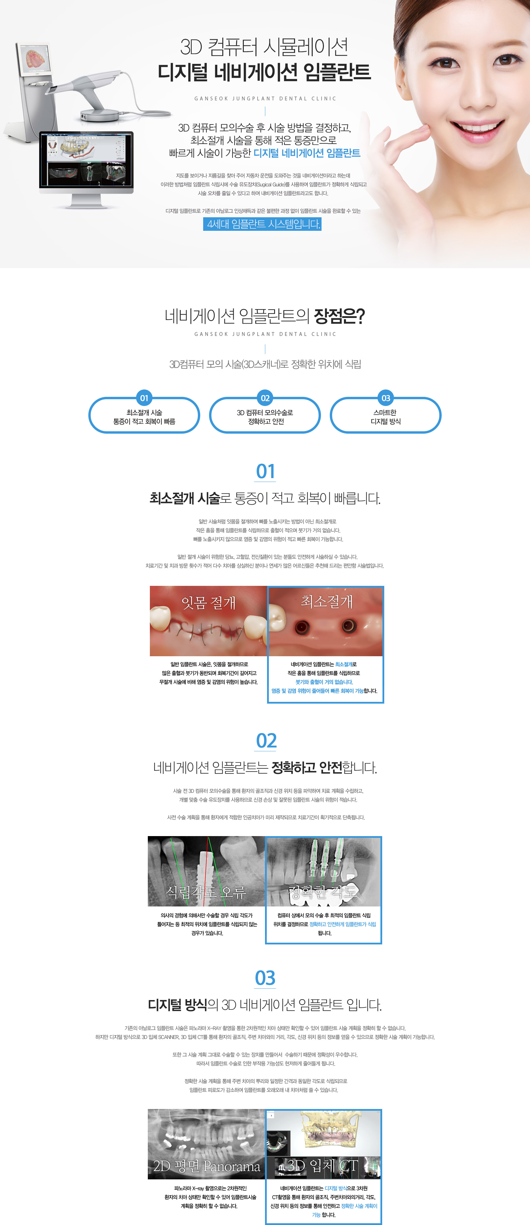 네비게이션 임플란트