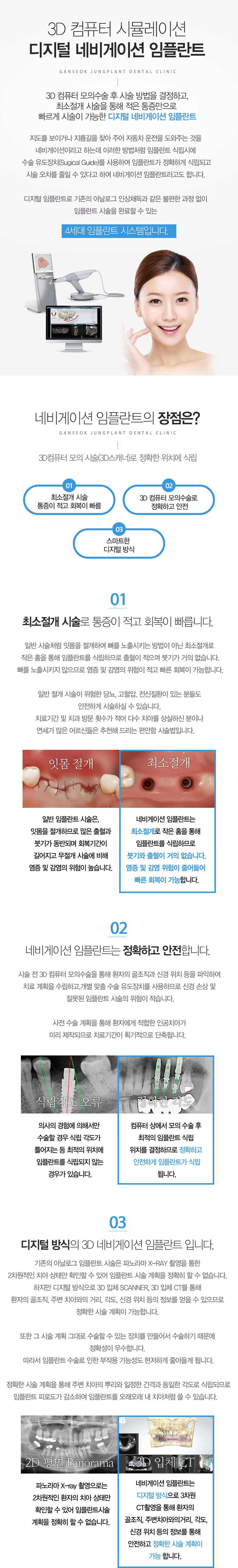 네비게이션 임플란트